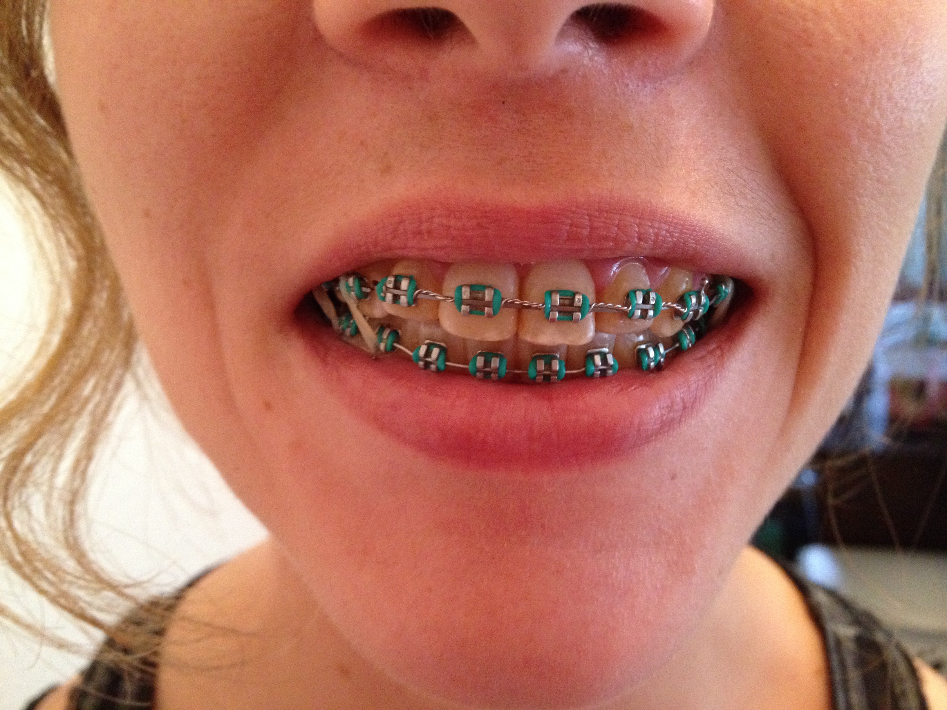 Orthodontists Canberra